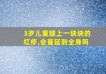 3岁儿童腿上一块块的红疹,会蔓延到全身吗