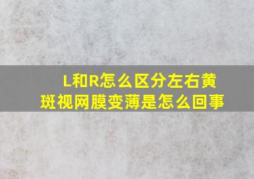 L和R怎么区分左右黄斑视网膜变薄是怎么回事