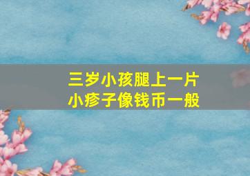 三岁小孩腿上一片小疹子像钱币一般