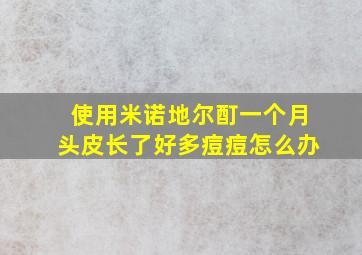 使用米诺地尔酊一个月头皮长了好多痘痘怎么办