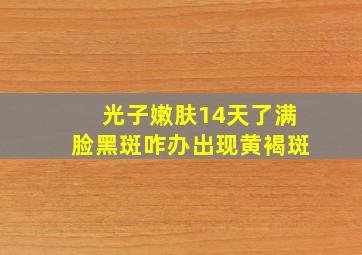 光子嫩肤14天了满脸黑斑咋办出现黄褐斑