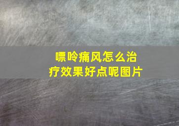 嘌呤痛风怎么治疗效果好点呢图片