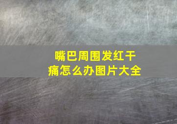 嘴巴周围发红干痛怎么办图片大全