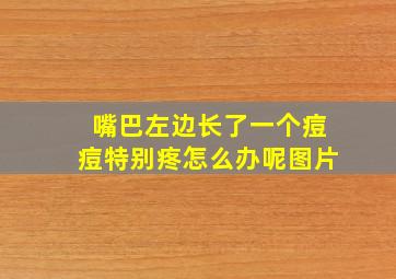 嘴巴左边长了一个痘痘特别疼怎么办呢图片