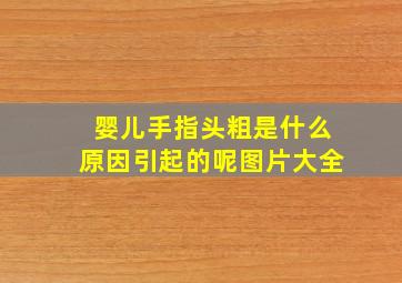 婴儿手指头粗是什么原因引起的呢图片大全