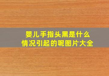 婴儿手指头黑是什么情况引起的呢图片大全