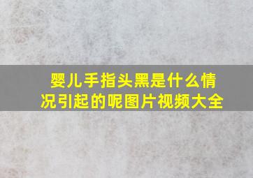 婴儿手指头黑是什么情况引起的呢图片视频大全