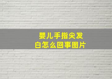 婴儿手指尖发白怎么回事图片