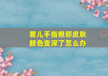 婴儿手指根部皮肤颜色变深了怎么办