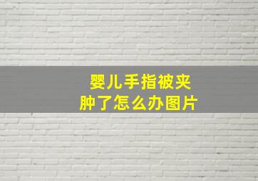 婴儿手指被夹肿了怎么办图片