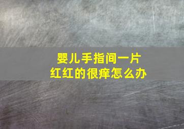 婴儿手指间一片红红的很痒怎么办