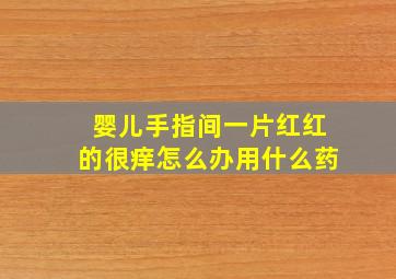 婴儿手指间一片红红的很痒怎么办用什么药