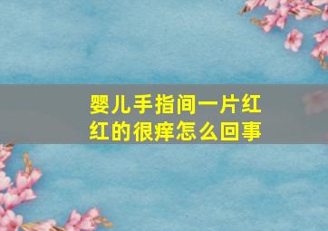 婴儿手指间一片红红的很痒怎么回事