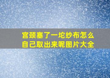 宫颈塞了一坨纱布怎么自己取出来呢图片大全