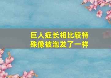 巨人症长相比较特殊像被泡发了一样