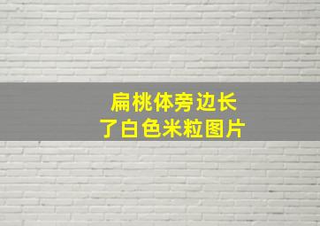 扁桃体旁边长了白色米粒图片