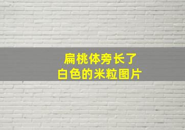 扁桃体旁长了白色的米粒图片