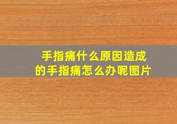 手指痛什么原因造成的手指痛怎么办呢图片