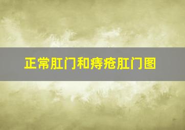 正常肛门和痔疮肛门图