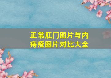 正常肛门图片与内痔疮图片对比大全