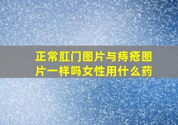 正常肛门图片与痔疮图片一样吗女性用什么药