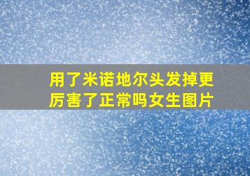 用了米诺地尔头发掉更厉害了正常吗女生图片