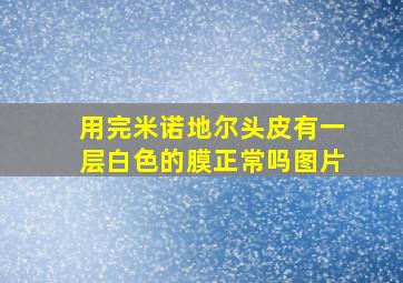 用完米诺地尔头皮有一层白色的膜正常吗图片