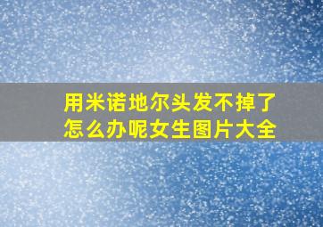 用米诺地尔头发不掉了怎么办呢女生图片大全