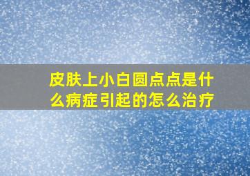 皮肤上小白圆点点是什么病症引起的怎么治疗