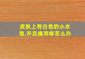 皮肤上有白色的小水泡,并且痛而痒怎么办