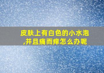 皮肤上有白色的小水泡,并且痛而痒怎么办呢