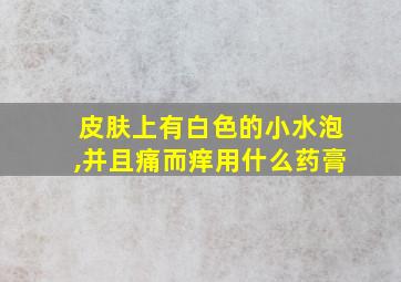 皮肤上有白色的小水泡,并且痛而痒用什么药膏