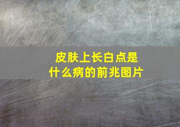 皮肤上长白点是什么病的前兆图片