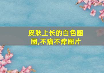 皮肤上长的白色圈圈,不痛不痒图片