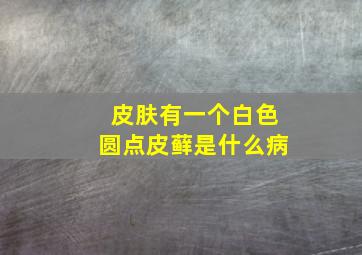 皮肤有一个白色圆点皮藓是什么病