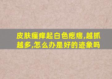 皮肤瘙痒起白色疙瘩,越抓越多,怎么办是好的迹象吗