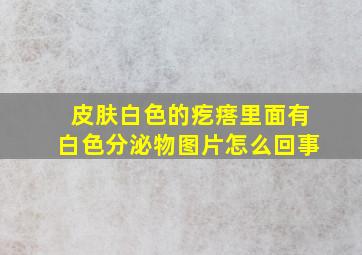 皮肤白色的疙瘩里面有白色分泌物图片怎么回事