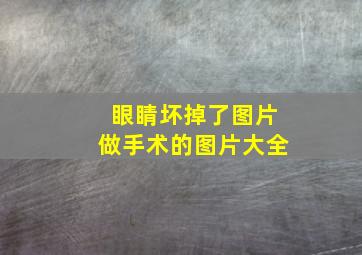 眼睛坏掉了图片做手术的图片大全