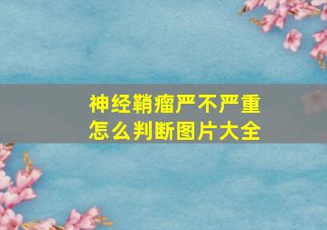 神经鞘瘤严不严重怎么判断图片大全