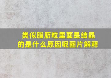 类似脂肪粒里面是结晶的是什么原因呢图片解释