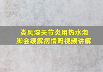 类风湿关节炎用热水泡脚会缓解病情吗视频讲解