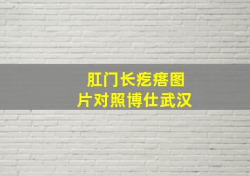 肛门长疙瘩图片对照博仕武汉