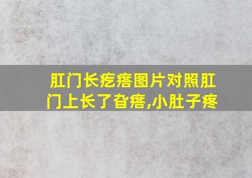 肛门长疙瘩图片对照肛门上长了旮瘩,小肚子疼