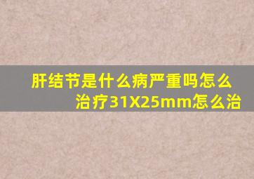 肝结节是什么病严重吗怎么治疗31X25mm怎么治