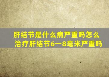 肝结节是什么病严重吗怎么治疗肝结节6一8亳米严重吗