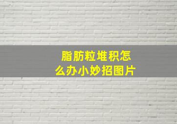 脂肪粒堆积怎么办小妙招图片