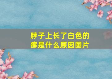 脖子上长了白色的癣是什么原因图片