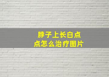 脖子上长白点点怎么治疗图片