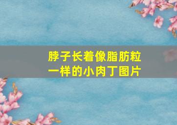 脖子长着像脂肪粒一样的小肉丁图片