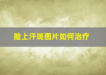 脸上汗斑图片如何治疗